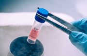 Stem Cells and Back Pain