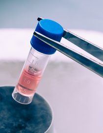 Hope for Back Pain Relief in the Use of Stem Cells Hope for Back Pain Relief in the Use of Stem Cells
